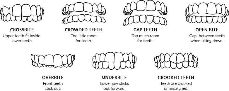 Invisalign Smile Assessment, Toddlers To Teens Children's Dentistry